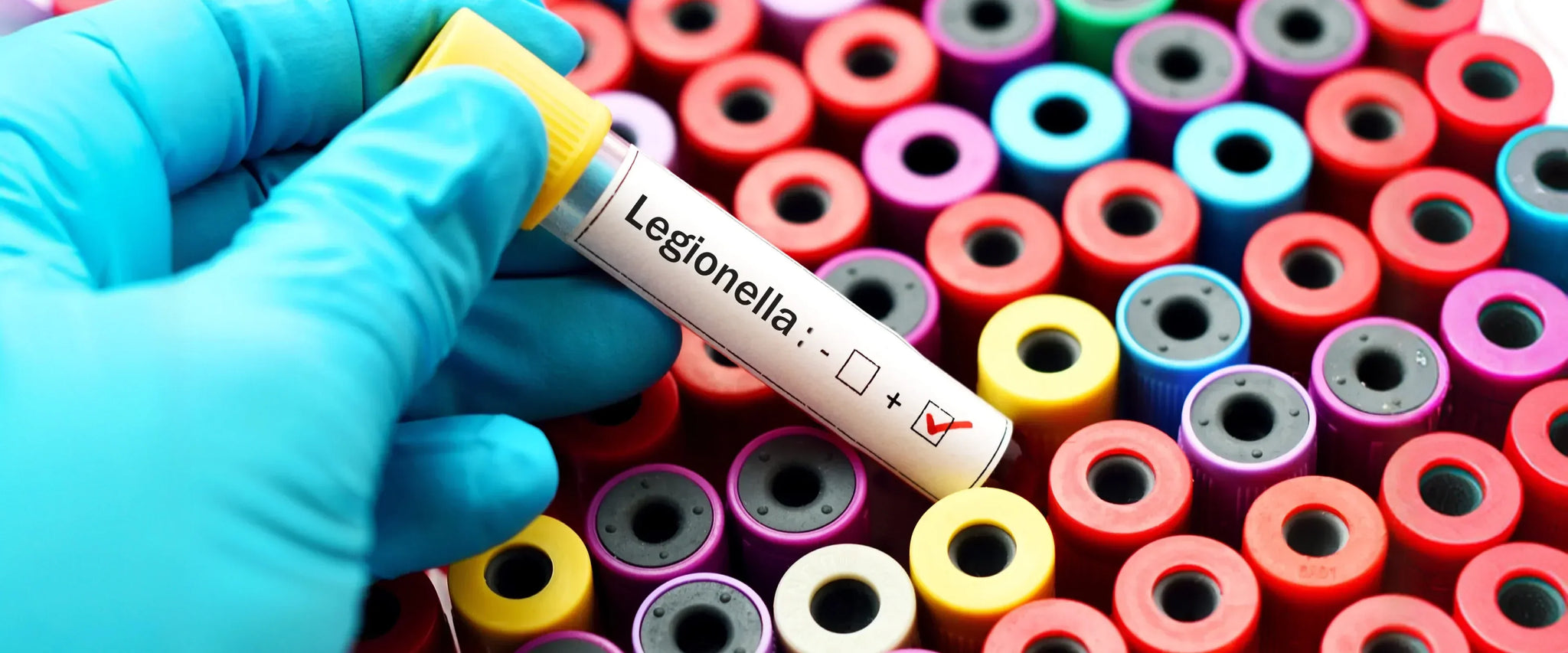 How To Remove Legionella From Your Supply – Fileder Filter Systems ...